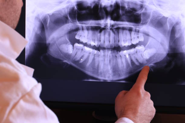 Best Broken or Chipped Tooth Repair in Lake Dallas, TX